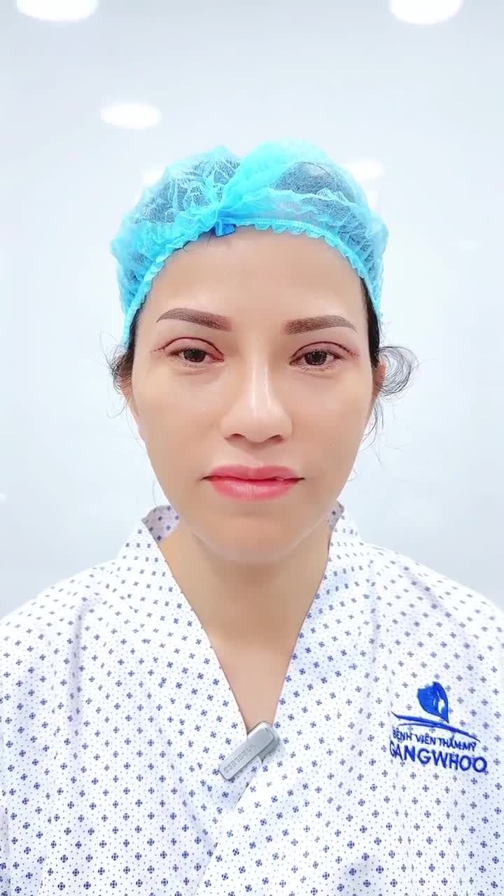 THĂNG HẠNG NHAN SẮC NHỜ THỰC HIỆN CẮT MẮT 4 IN 1 TẠI BVTM GANGWHOO