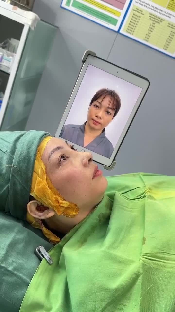 KẾT QUẢ NÂNG MŨI CẤU TRÚC SAU 60 PHÚT | KH. NGỌC THẢO (TÂY NINH)