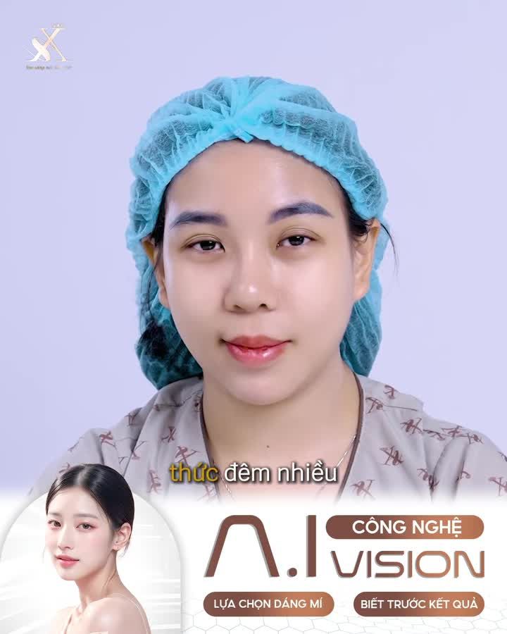 HẾT ÁM ẢNH CẮT MÍ – HỎNG LỖI, SẸO XẤU, MẤT THẨM MỸ