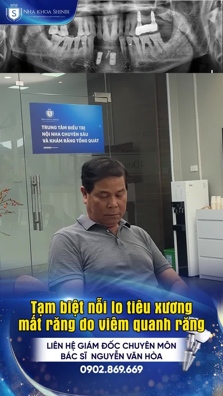 Tạm biệt nỗi lo tiêu xương - mất răng do viêm quanh răng
