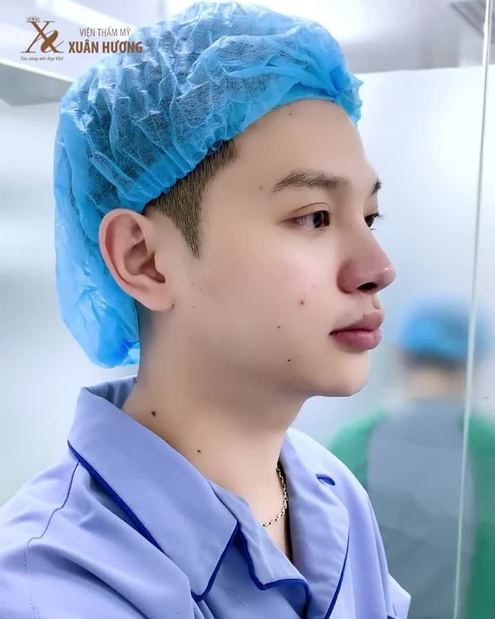 45 PHÚT NÂNG MŨI TẠI XUÂN HƯƠNG