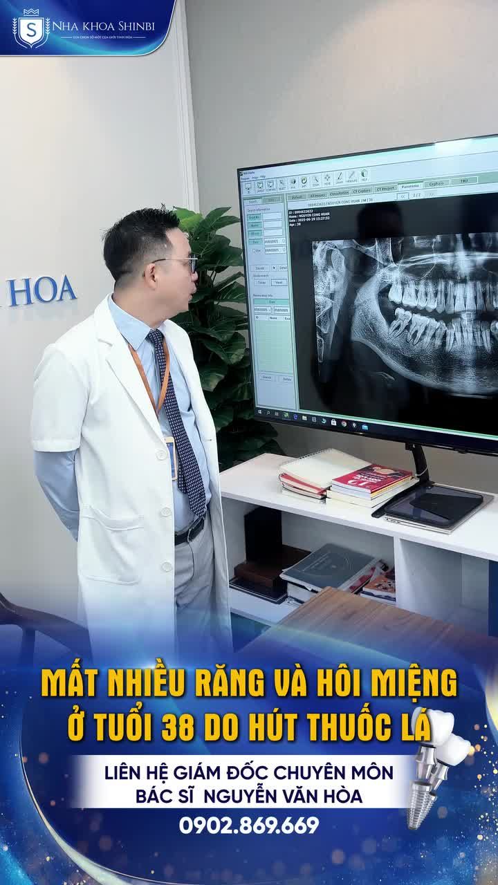 Câu chuyện khách hàng: Mất răng ở tuổi 38 vì thói quen hút thuốc lá
