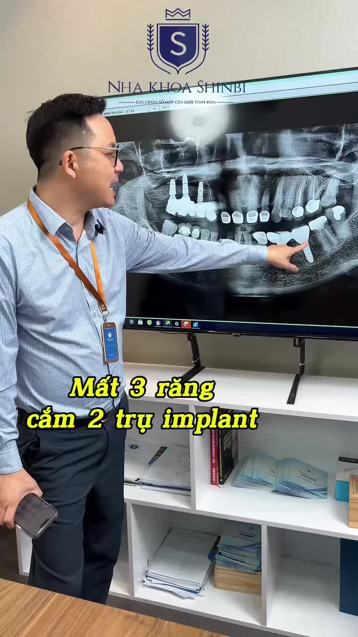 GIẢI PHÁP TRỒNG RĂNG IMPLANT VÀ LÀM CẦU CHO NGƯỜI MẤT NHIỀU RĂNG
