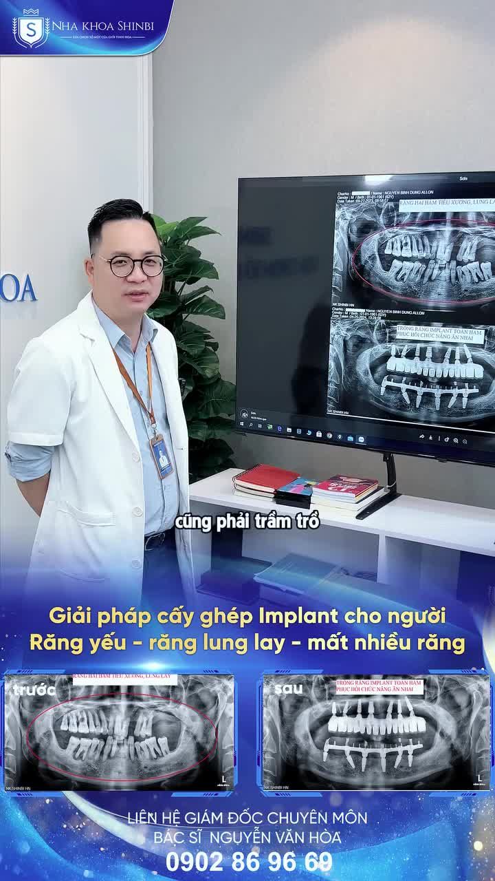 GIẢI PHÁP CẤY GHÉP IMPLANT CHO TÌNH TRẠNG RĂNG YẾU - RĂNG LUNG LAY - MẤT NHIỀU RĂNG