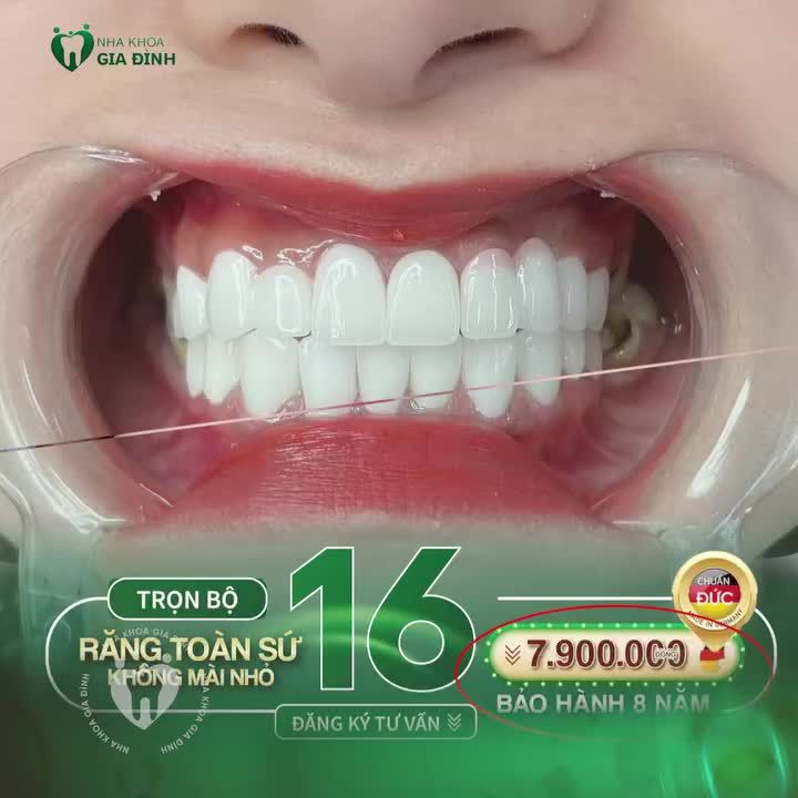 BỌC RĂNG SỨ GIÁ RẺ – CÁI BẪY KHIẾN BẠN TIỀN MẤT, TẬT MANG