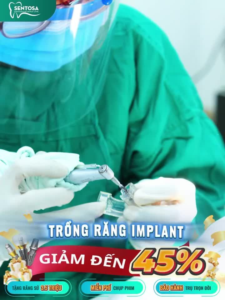 HỖ TRỢ TRỒNG RĂNG IMPLANT ĐẾN 45% - 5 SUẤT ƯU ĐÃI DUY NHẤT