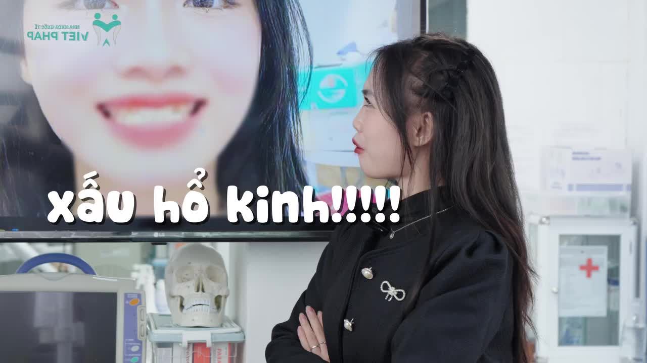 Hotgirl Nam Định Thay Đổi 180 Độ Sau Làm Răng Sứ