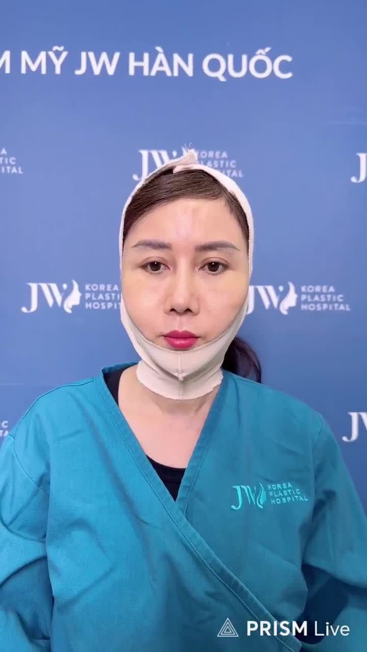 Quý cô U50 Sài Thành xóa sạch 90% lão hóa TRẺ NHƯ GÁI 18 sẹo vô hình chỉ sau 1 lần CĂNG CHỈ MESH LIFT tại JW