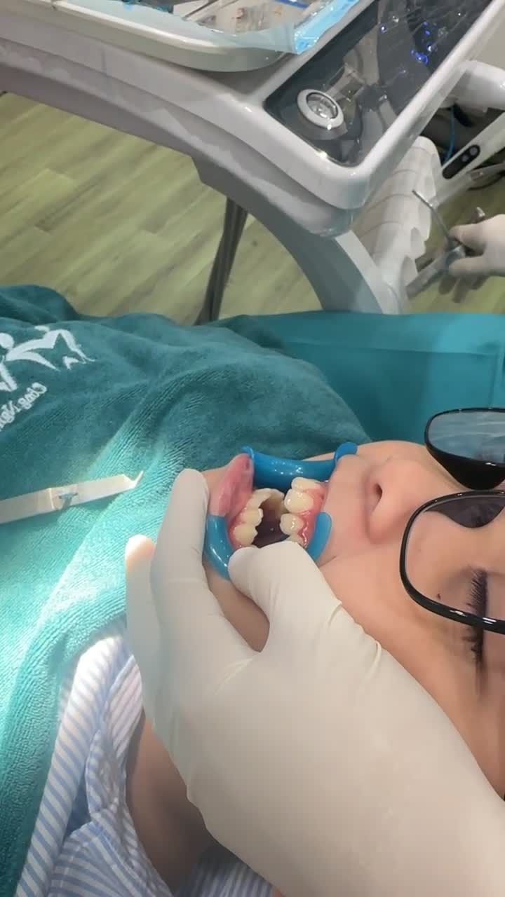 Khách hàng nhí chỉnh nha tại Nha Khoa quốc tế Việt Pháp cs Hà Đông