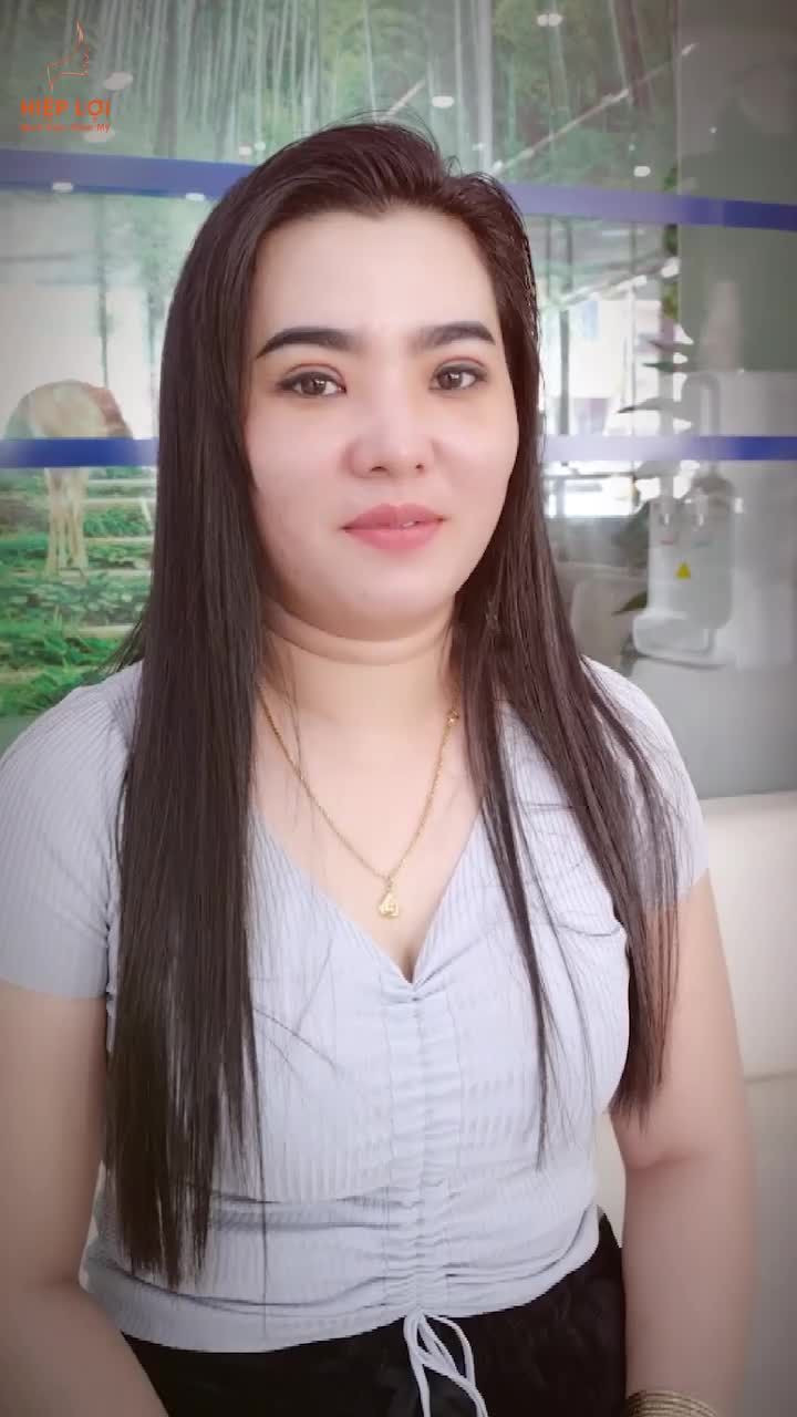 Khách hàng thay đổi rõ rệt trước – sau, không sưng nhiều, phục hồi nhanh.