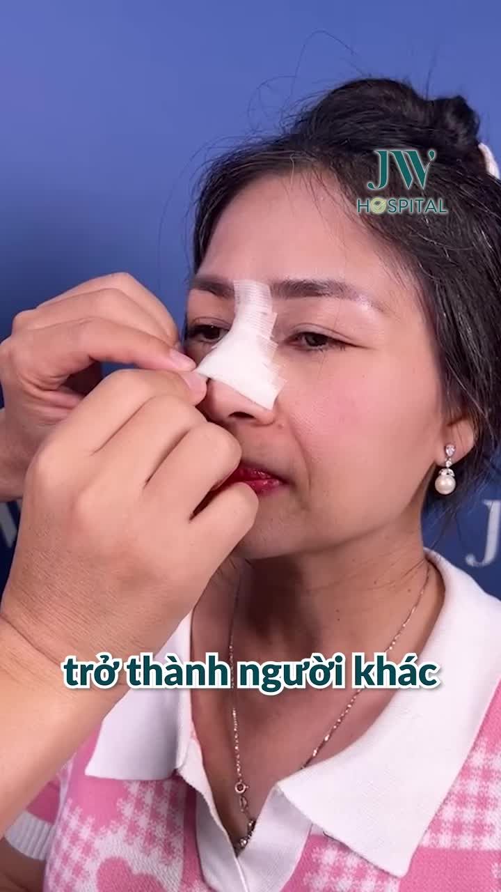 QUÝ CÔ U50 SỞ HỮU MŨI CAO SANG CHẢNH NHỜ NÂNG MŨI S LINE TẠI JW