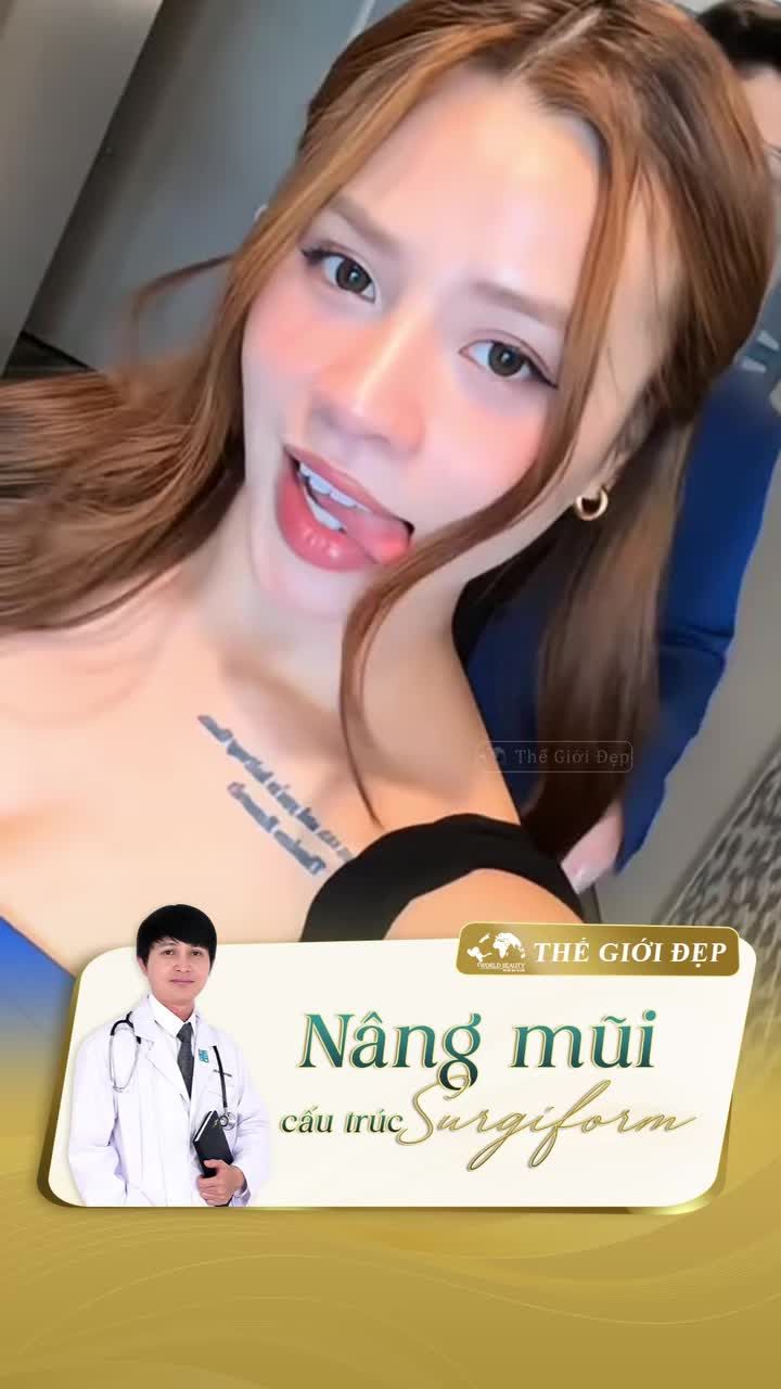 Dáng mũi cấu trúc 1,5 năm tuổi của Khách hàng Việt kiều tin chọn Thế Giới Đẹp để thăng hạng nhan sắc cho bản thân!