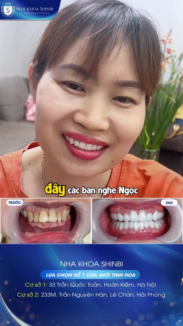 LÀM RĂNG SỨ ĐẸP – KHÔNG ÁP LỰC TÀI CHÍNH