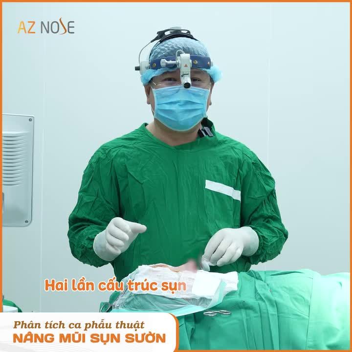 Tái tạo dáng mũi cho khách hành từng 4 lần nâng mũi hỏng