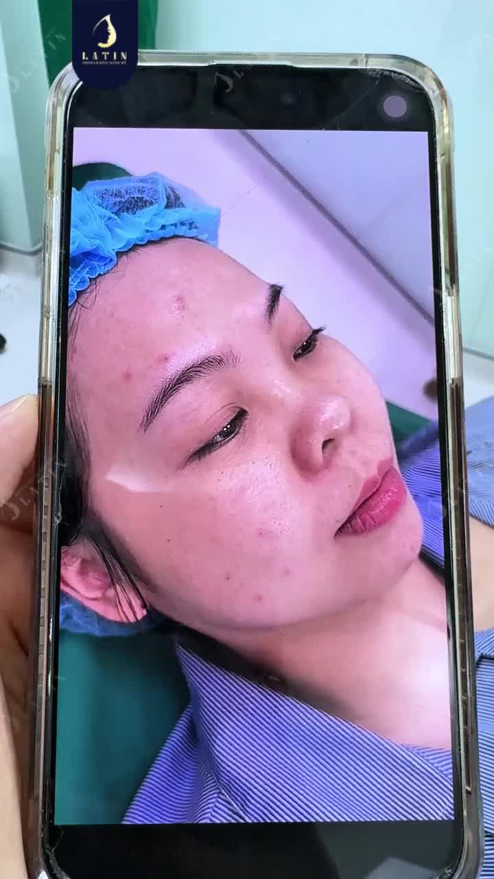 CẬN CẢNH  GÓC NGHIÊNG XINH HẾT NẤC