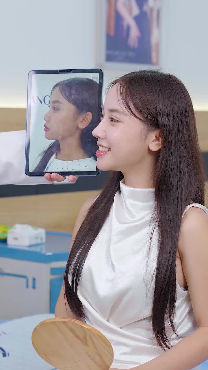 KH quay trở lại sau nâng mũi 1 tháng tại Thẩm mỹ Vũ Quang