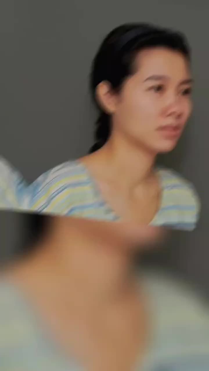 Một dáng mũi thấp trũng, sống mũi gồ khiến khuôn mặt mất đi sự thanh thoát vốn có.