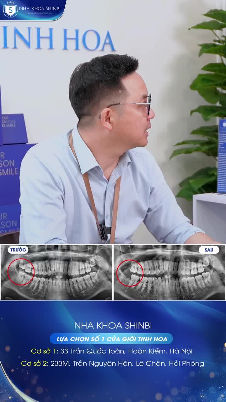CÓ PHẢI RĂNG SỐ 8 NÀO CŨNG CẦN 