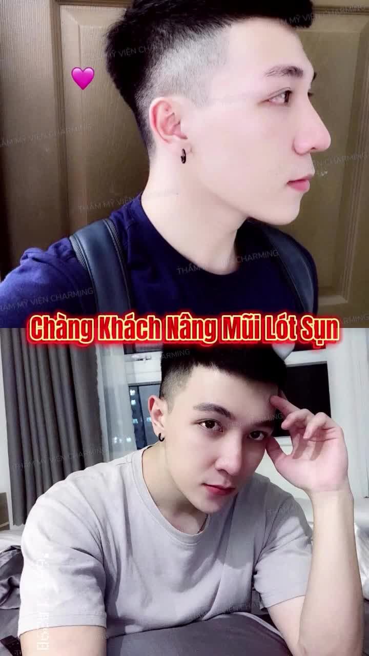 Sự kết hợp giữa dáng mũi chuẩn tỉ lệ và gương mặt góc cạnh đã tạo nên một tổng thể cực cuốn hút.