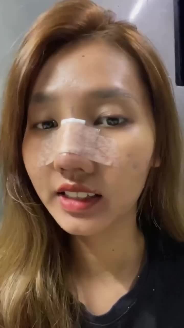 Khách trước và sau khi nâng mũi kiểu sơ hở là xinh mọi góc nhìn. Tự tin quay chụp đều đều, mình cứ này thôi nhé khách
