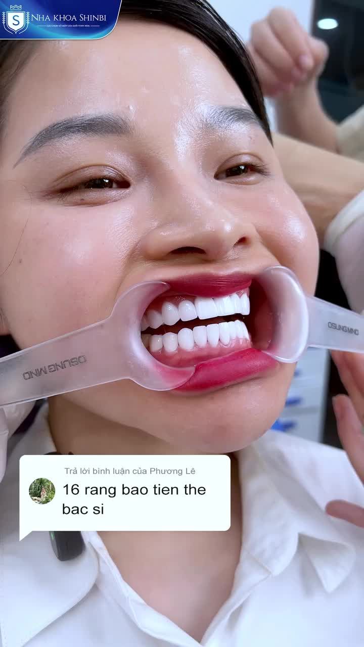 HÀM RĂNG TRẮNG SÁNG KHÔNG TÌ VẾT TẠI SHINBI