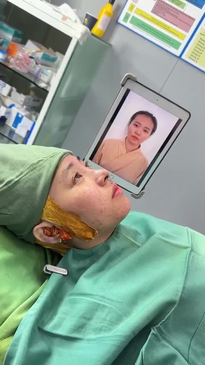 ĐƯỢC GIA ĐÌNH ĐỘNG VIÊN ĐI NÂNG MŨI VÀ CÁI KẾT VIÊN MÃN