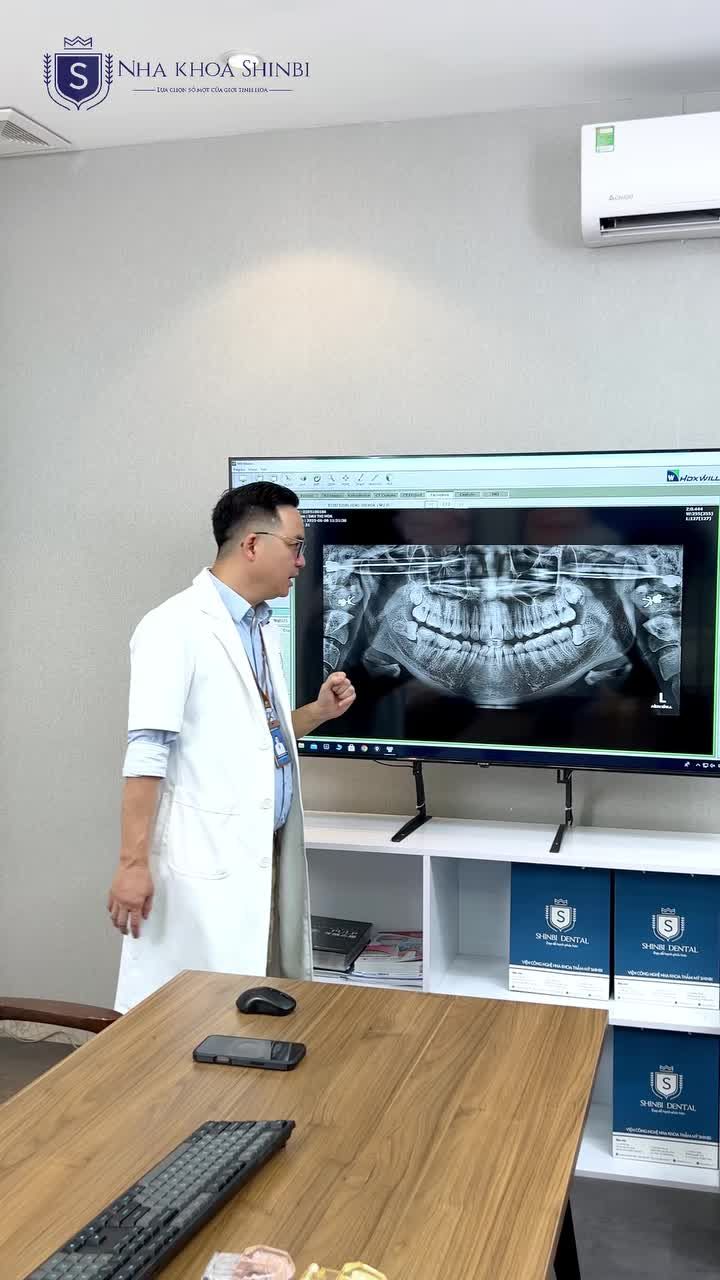 NHỔ RĂNG SỐ 8 KHÔNG SANG CHẤN