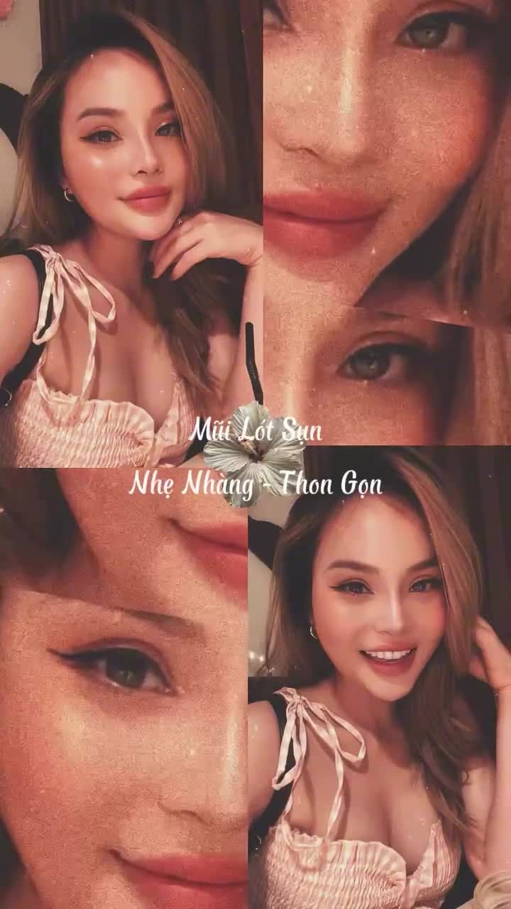 Dáng mũi sau khi được nâng lót sụn, chỉnh gồ kết hợp cắt cánh mũi đã thay đổi đáng kể đường nét khuôn mặt.