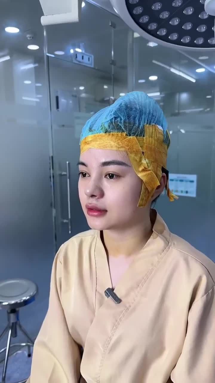 KẾT QUẢ NÂNG MŨI CẤU TRÚC DR. HOẠT - CHINH PHỤC KHÁCH HÀNG GEN Z