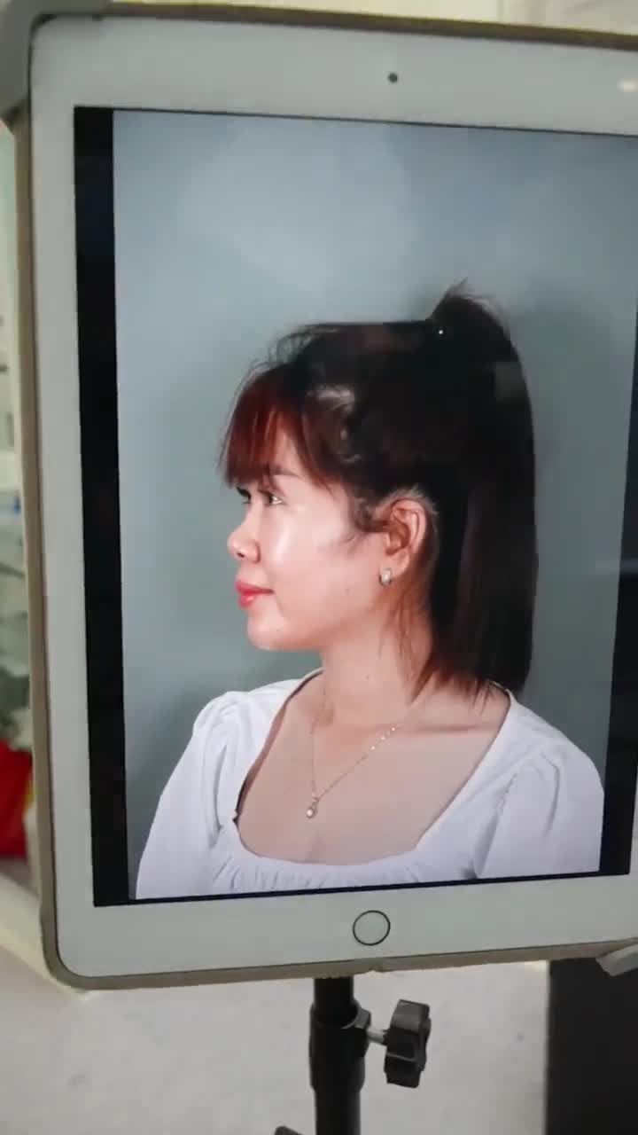 LỘ DIỆN NHAN SẮC MỚI - RẠNG NGỜI SAU NÂNG MŨI CẤU TRÚC