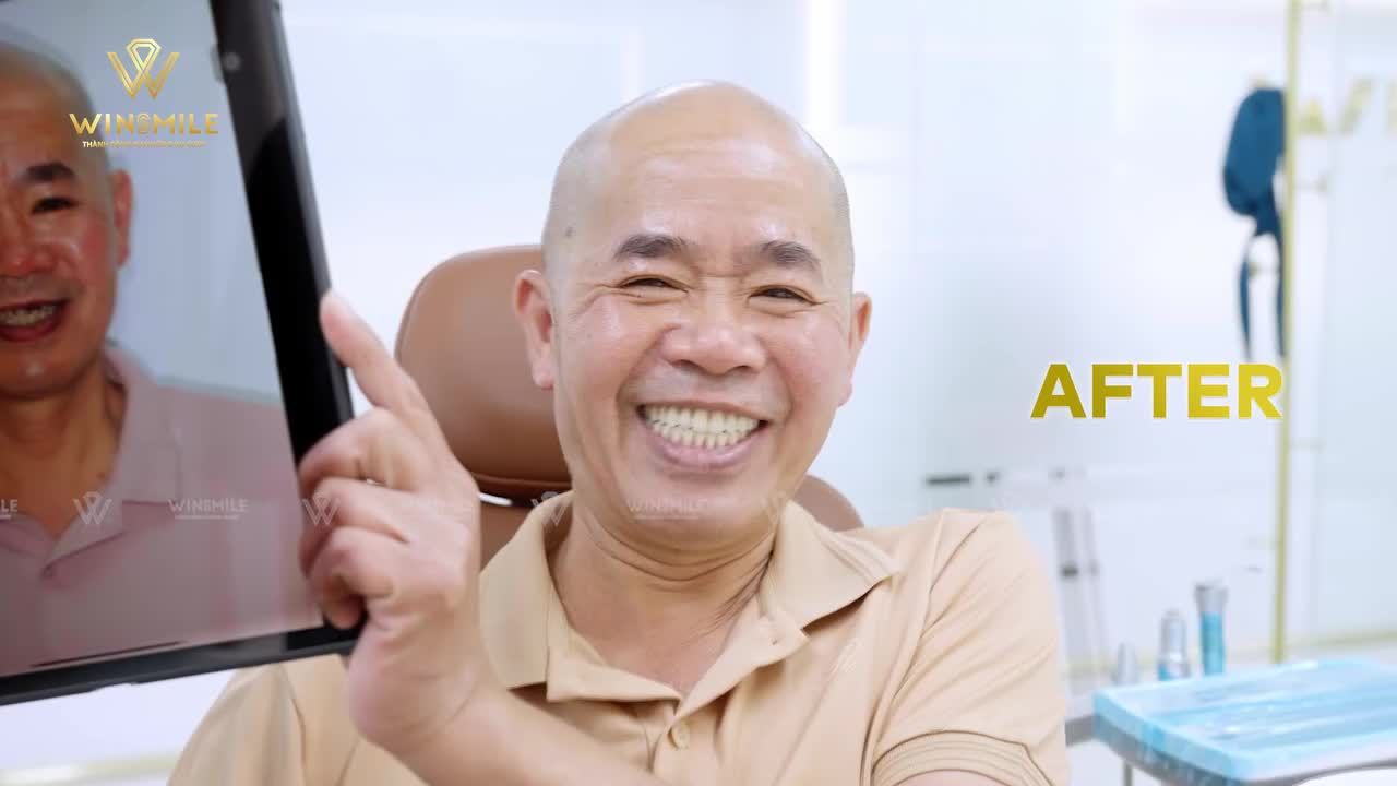 NIỀM HẠNH PHÚC ĐƯỢC SỐNG ĐÚNG VỚI ĐỘ TUỔI CỦA MÌNH SAU HÀNH TRÌNH LỘT XÁC NỤ CƯỜI VỚI IMPLANT ALL-ON-4