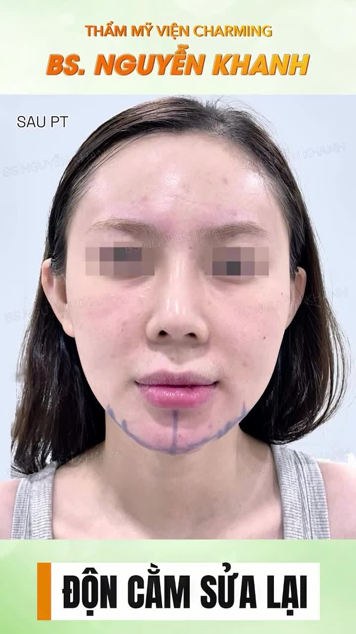 Charming luôn đặt sự tinh tế trong từng dáng cằm – để mỗi khách hàng đều có vẻ đẹp riêng biệt và tự nhiên nhất.