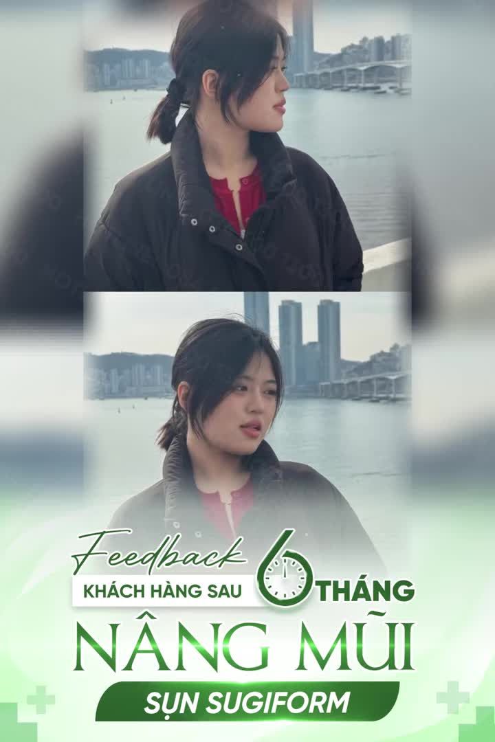 FEEDBACK KHÁCH SAU 6 THÁNG N.ÂNG MŨI + SỤN SURGIFORM