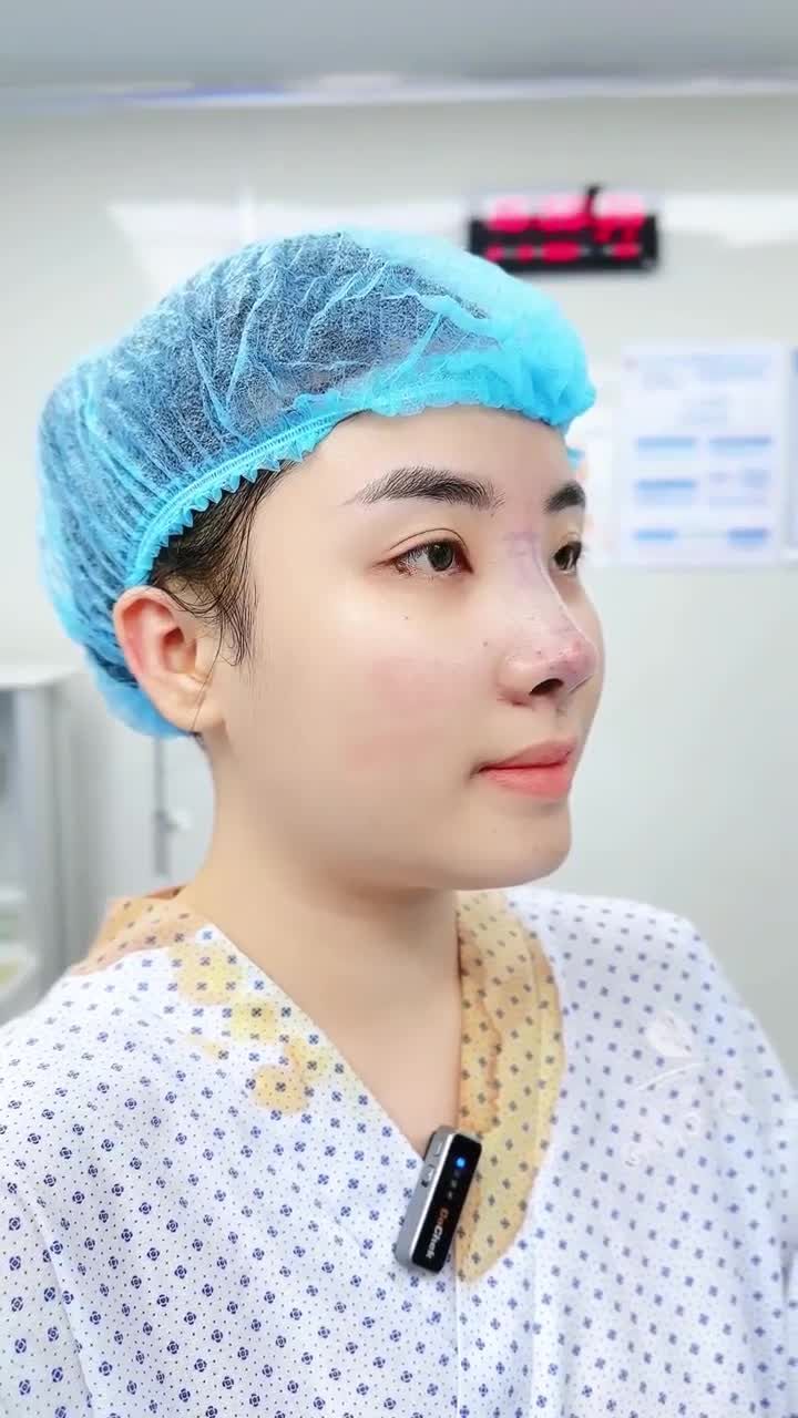 BẠN NỮ TRẺ TUỔI LỘT XÁC NHAN SẮC SAU 60 PHÚT NÂNG MŨI TẠI BỆNH VIỆN THẨM MỸ GANGWHOO – DÁNG MŨI THANH TÚ, GƯƠNG MẶT HÀI HÒA!
