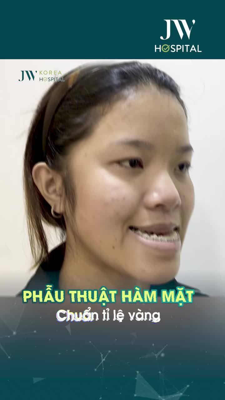 TOP 4 CA PHẪU THUẬT HÀM GEN Z - VỊT HÓA THIÊN NGA