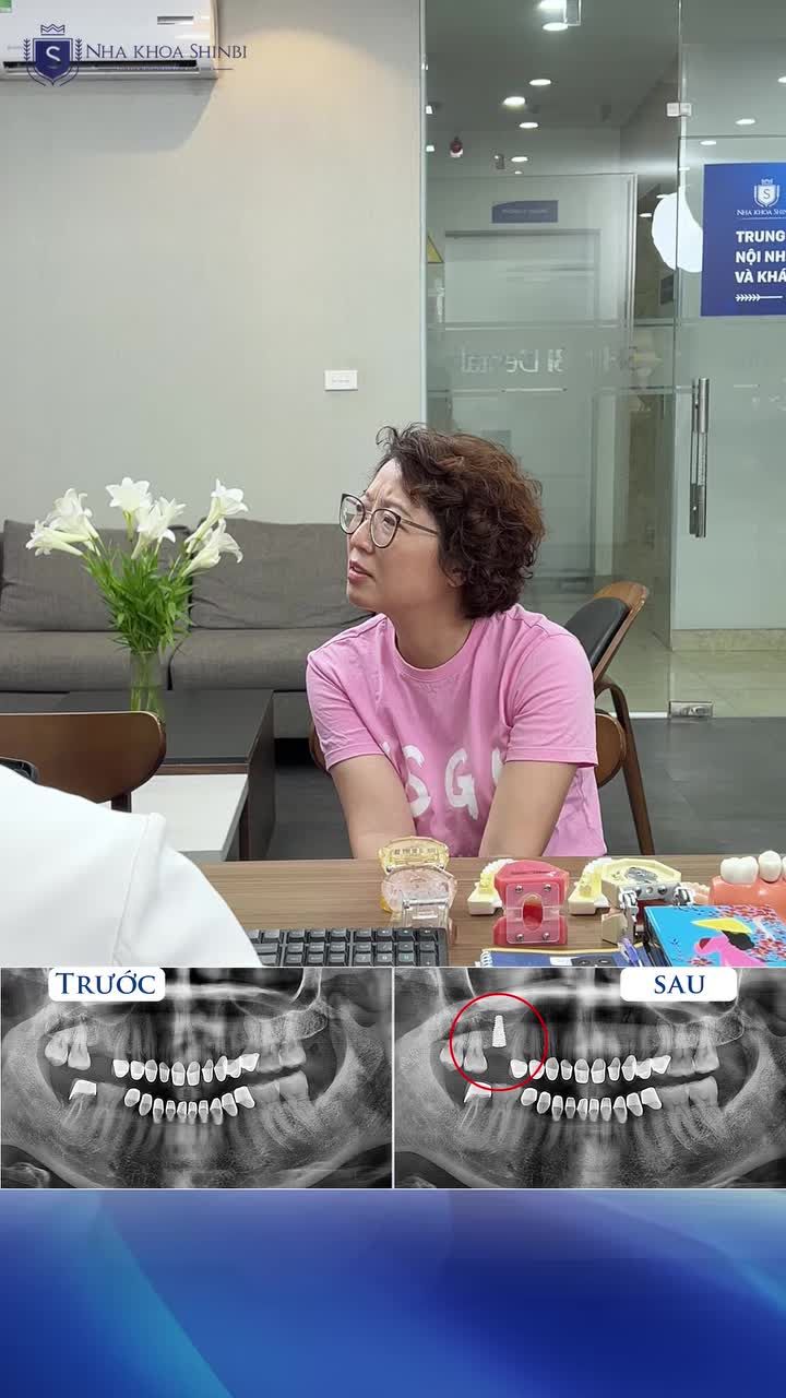 TRỒNG RĂNG IMPLANT PHÙ HỢP CHO PHỤ NỮ U50.