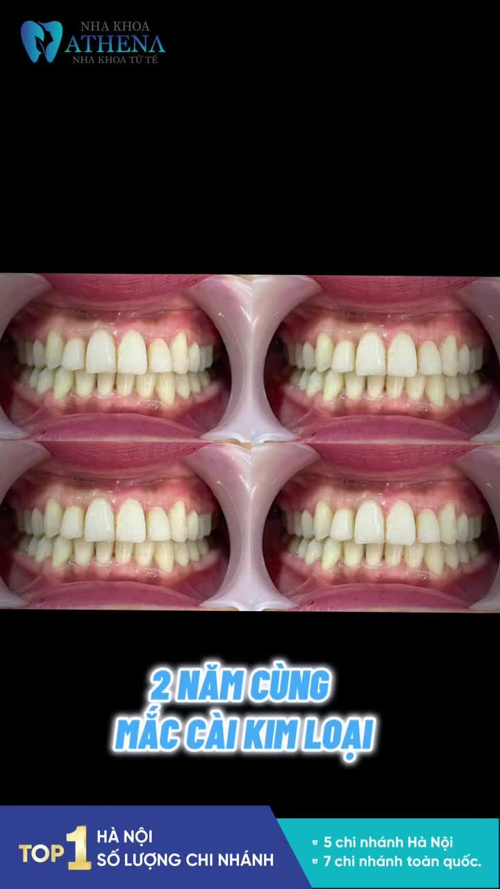 CHÚC MỪNG THÁO NIỀNG