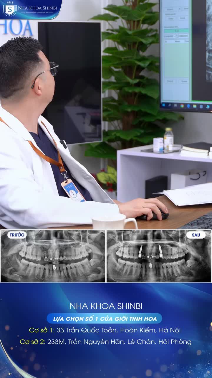 Chị khách hàng 8x và ca nhổ răng sữa đặc biệt tại Shinbi – trải nghiệm nhẹ nhàng, nụ cười rạng rỡ.