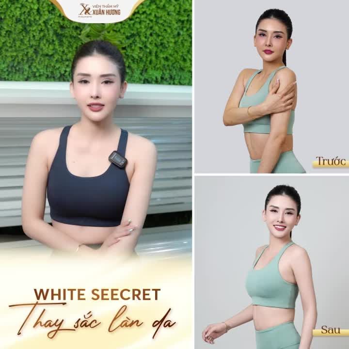 ĐỔI DA ĐEN NHẺM – LẤY LẠI LÀN DA TRẮNG SÁNG BẬT TONE