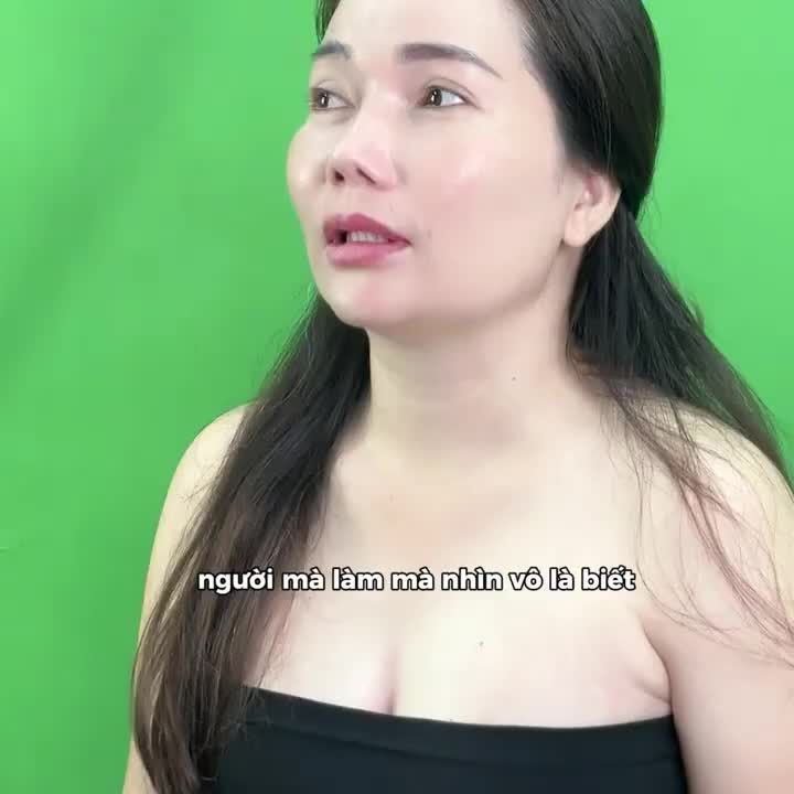 THAY ĐỔI TÌNH TRẠNG SA TRỄ VỚI NÂNG V1 LIGA NANO BỞI THS-BS NGUYỄN TIẾN HUY