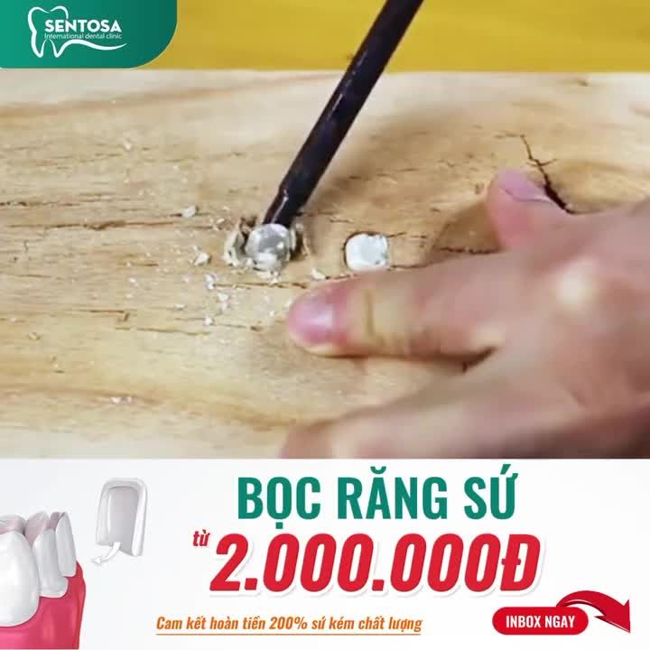 “TIỀN MẤT – RĂNG HỎNG” VÌ BỌC SỨ KÉM CHẤT LƯỢNG