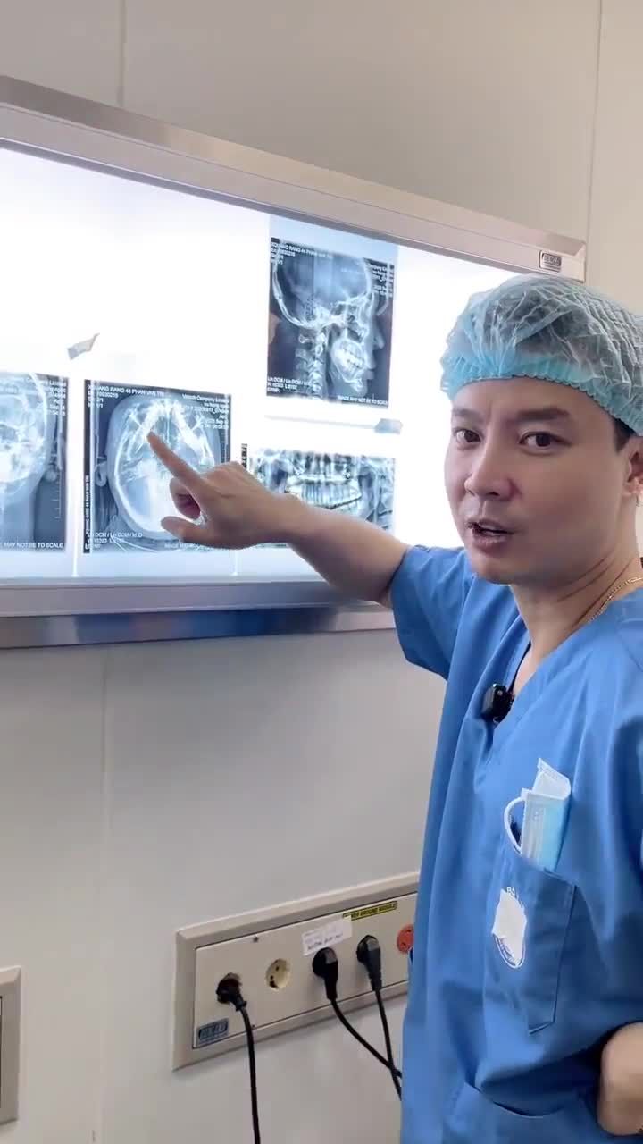 Phân tích tình trạng trước phẫu và kế hoạch chỉnh sửa