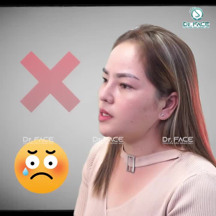 Sao Không Nâng Mũi Ở Trung Quốc?