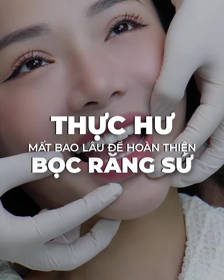 Bọc răng sứ mất bao lâu?