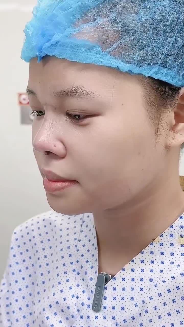 BẠN NỮ LỘT XÁC NHAN SẮC CHỈ SAU 60 PHÚT NÂNG MŨI TẠI GANGWHOO – DÁNG MŨI HÀI HÒA, GƯƠNG MẶT VƯƠN TẦM ĐẲNG CẤP!