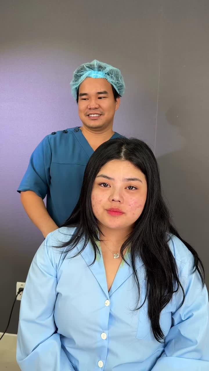 Case mũi cấu trúc cho bạn gái đến từ Úc!!