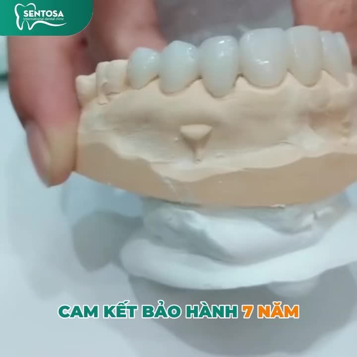 NÂNG TẦM NỤ CƯỜI VỚI RĂNG TOÀN SỨ CHÍNH HÃNG – GIẢM CÒN TỪ 2.000.000Đ