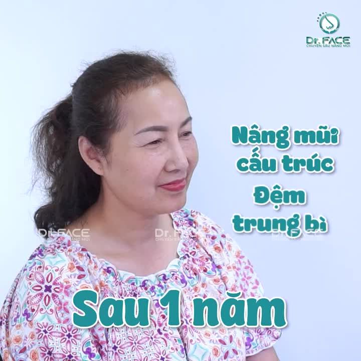 SAU 1 NĂM NÂNG MŨI, ĐIỀU CHỊ CÓ LÀ GÌ?
