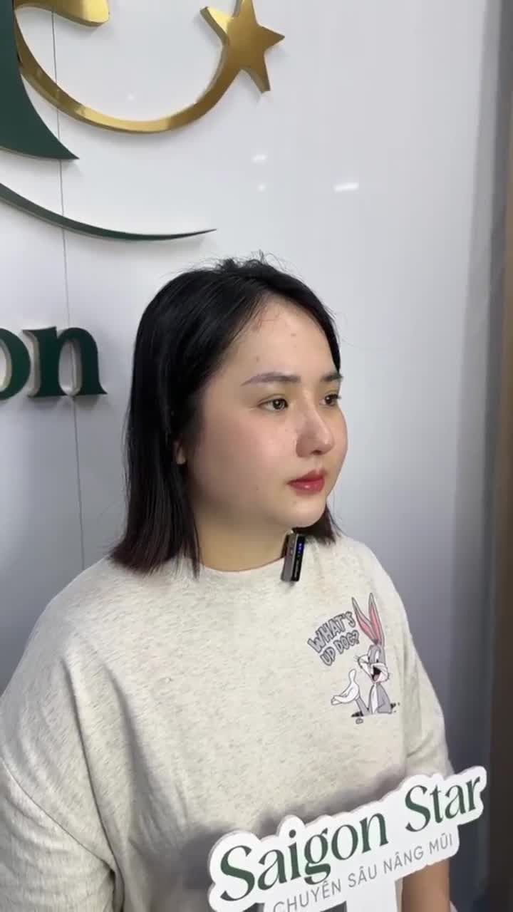 KẾT QUẢ SAU 10 NGÀY NÂNG MŨI CẤU TRÚC KH. KIỀU THU (BÌNH DƯƠNG)