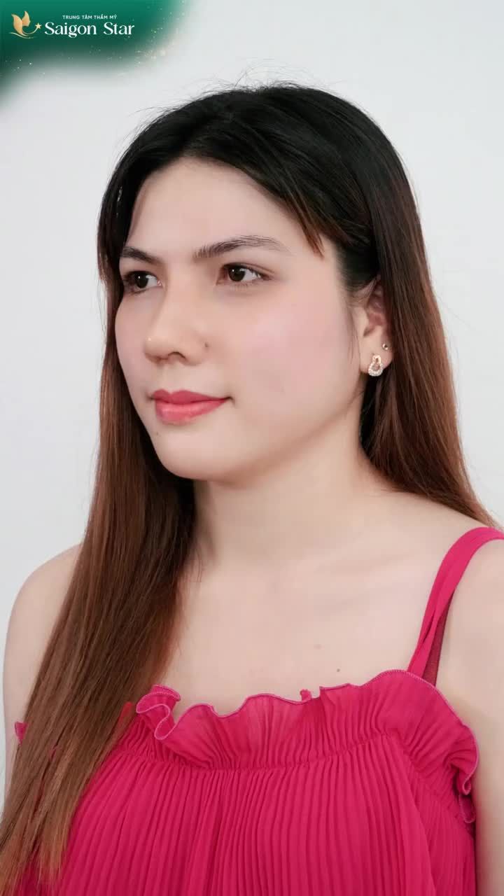 Hầu như các nàng nâng mũi tại Bác sĩ Hoạt sau khi tháo nẹp đều có chung 1 cảm xúc thế này.